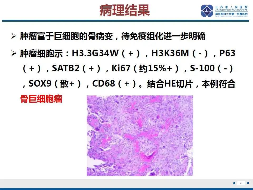 影像PPT - 【PPT】骨巨细胞瘤-22