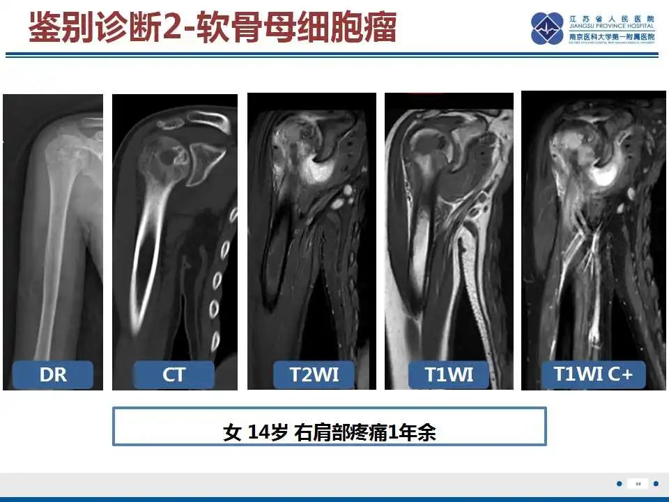 影像PPT - 【PPT】骨巨细胞瘤-40