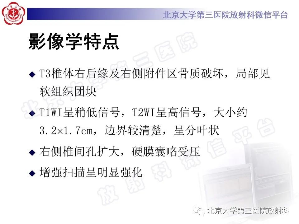 影像PPT - 【PPT】脊柱腱鞘巨细胞瘤-7