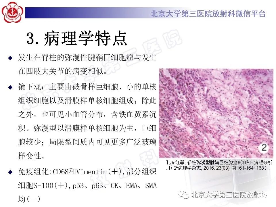 影像PPT - 【PPT】脊柱腱鞘巨细胞瘤-14