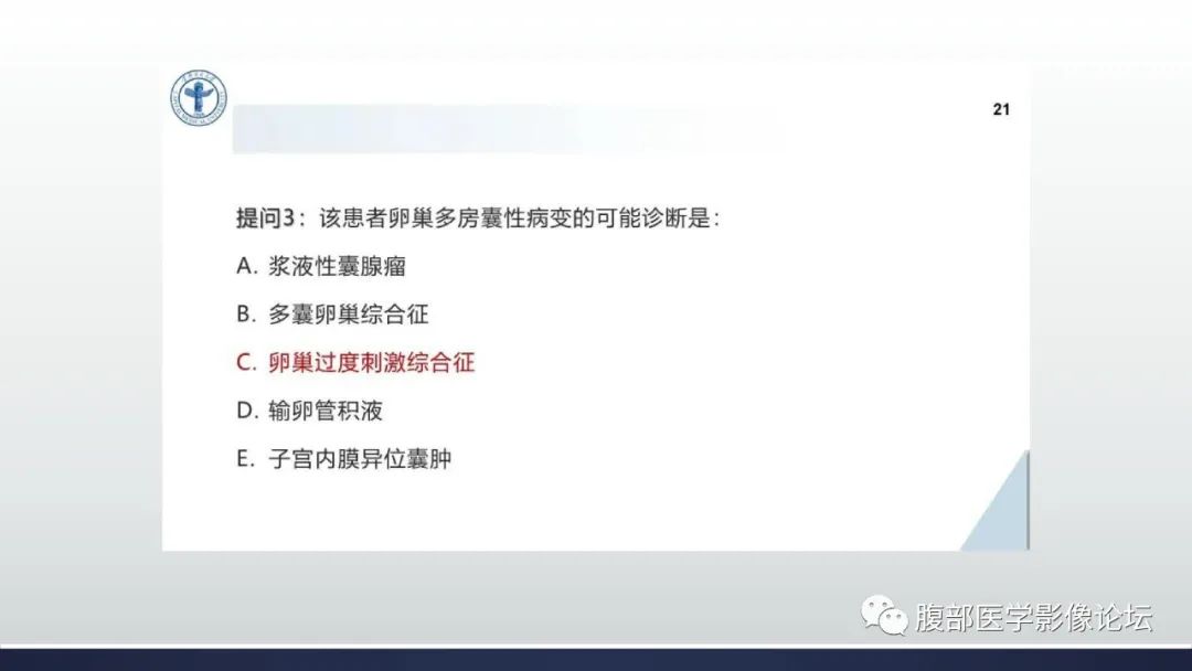 影像PPT - 【病例】卵巢过度刺激综合征1例MR影像-20