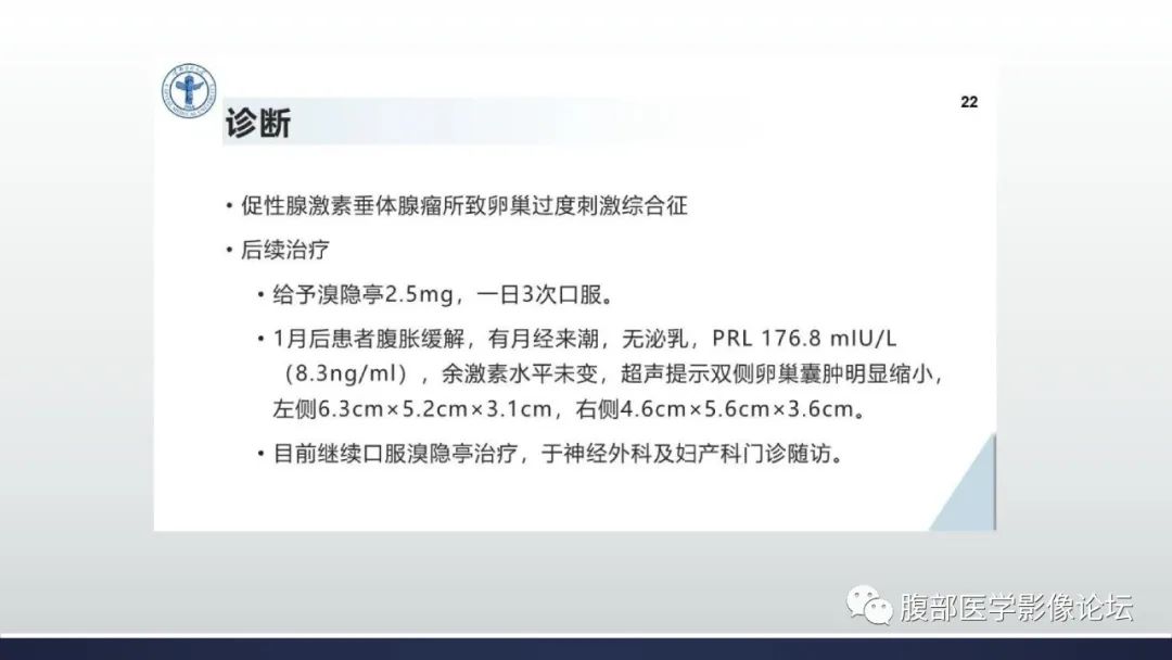 影像PPT - 【病例】卵巢过度刺激综合征1例MR影像-21