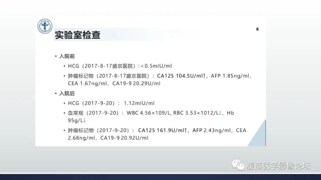 影像PPT - 【病例】卵巢过度刺激综合征1例MR影像-5