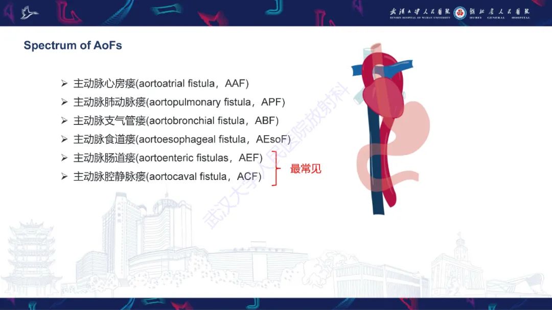 影像PPT - 【PPT】主动脉瘘影像诊断-6
