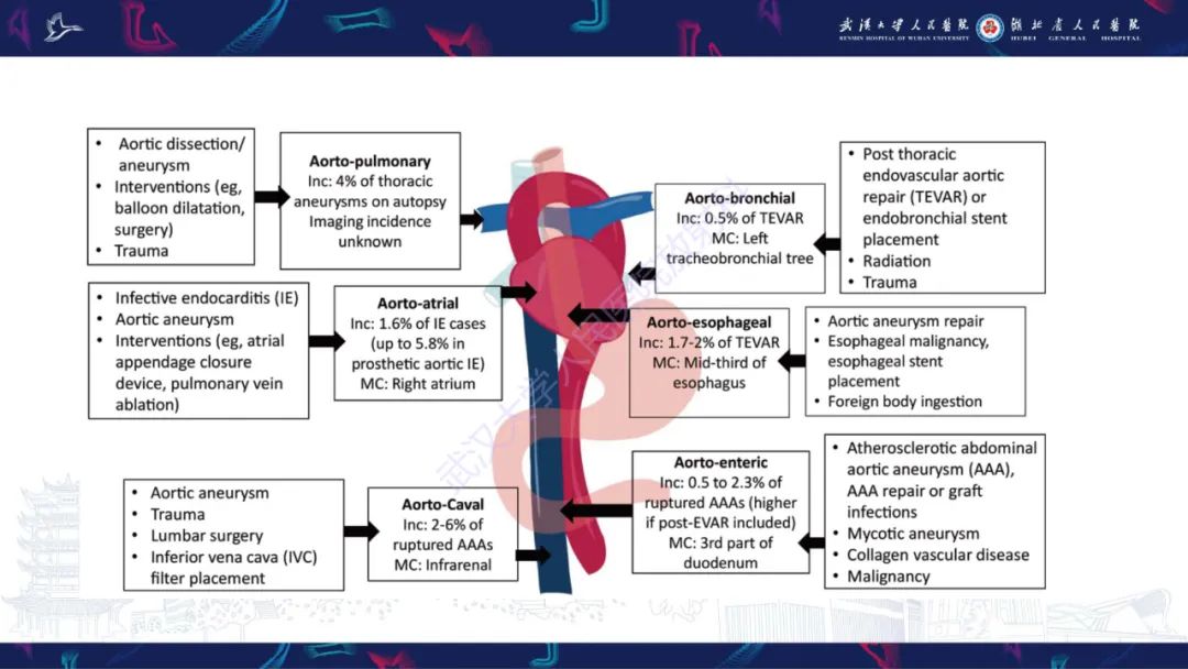 影像PPT - 【PPT】主动脉瘘影像诊断-5