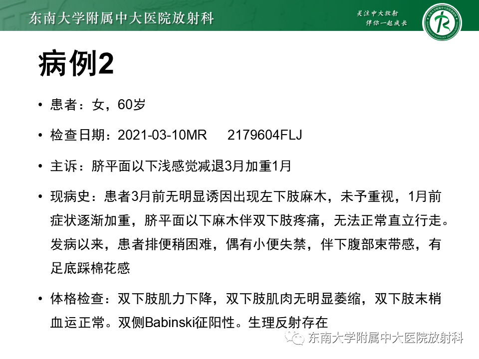 影像PPT - 【PPT】髓外硬膜下肿瘤-15