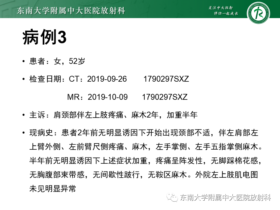 影像PPT - 【PPT】髓外硬膜下肿瘤-23