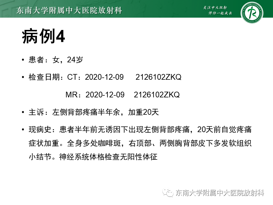 影像PPT - 【PPT】髓外硬膜下肿瘤-33