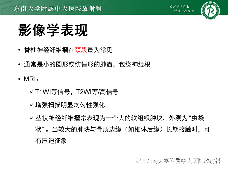 影像PPT - 【PPT】髓外硬膜下肿瘤-28
