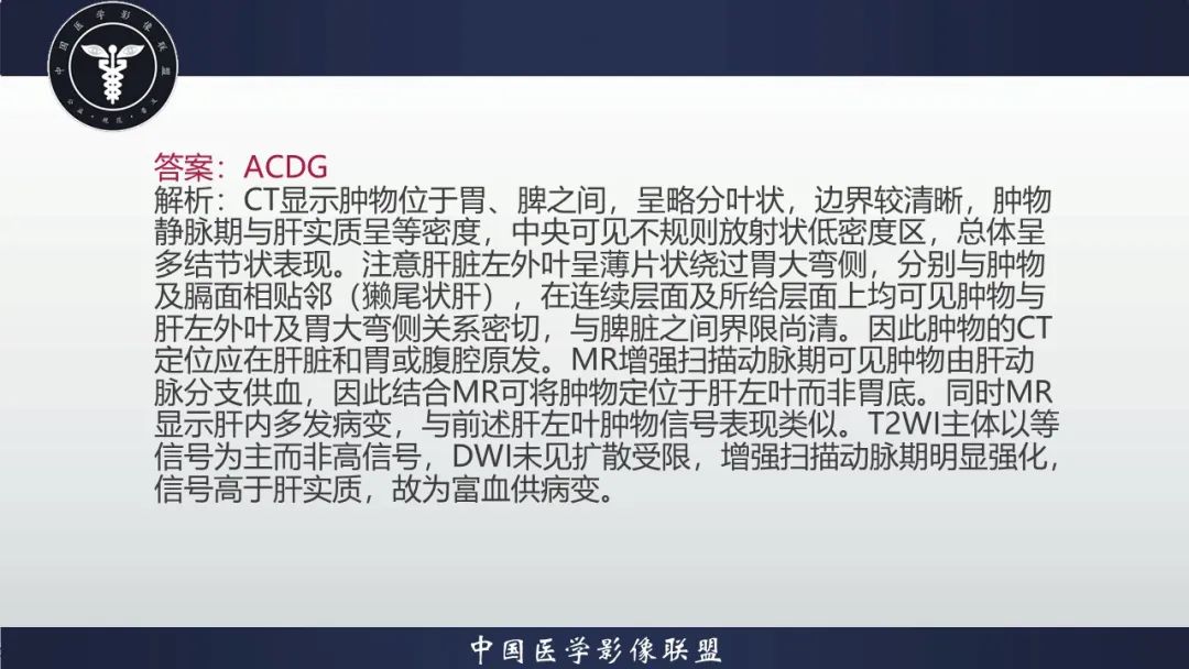 影像PPT - 【病例】肝脏局灶性结节增生1例CT及MR影像-6