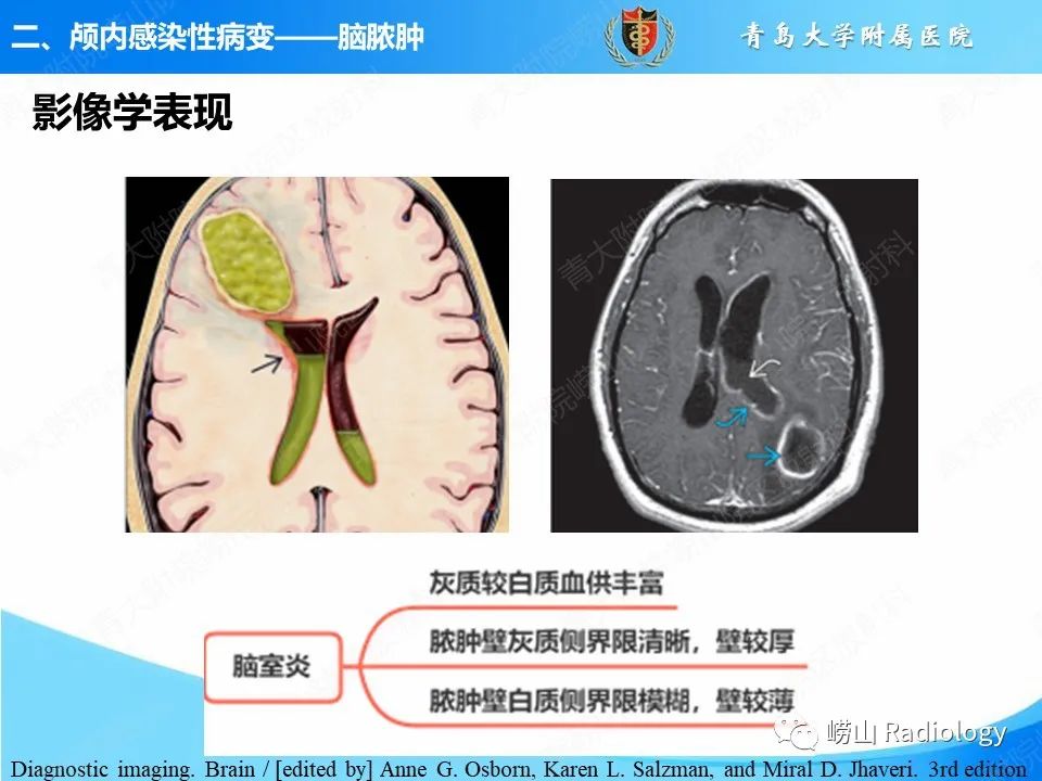 影像PPT - 【PPT】颅内感染性疾病-11