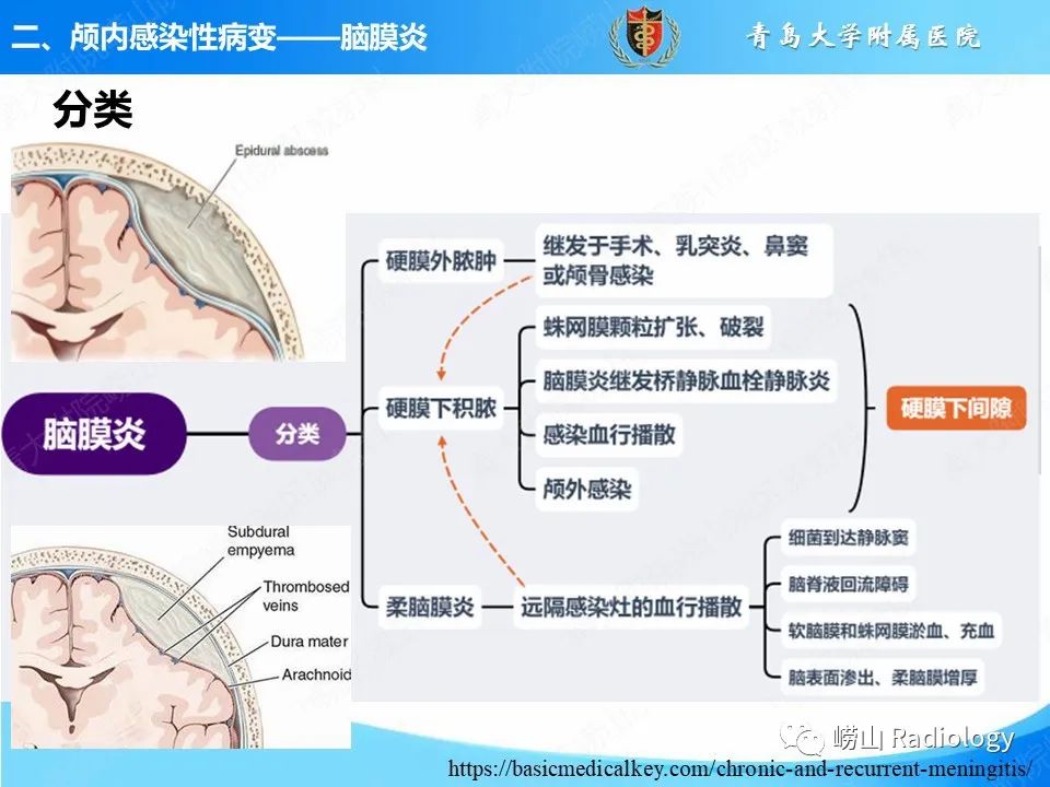 影像PPT - 【PPT】颅内感染性疾病-14