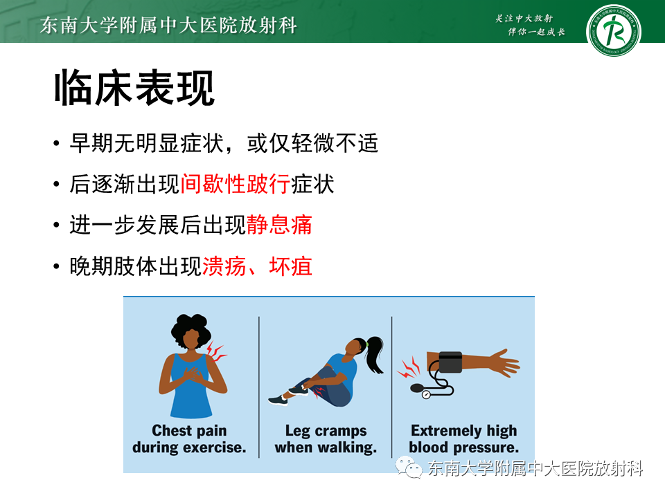影像PPT - 【PPT】下肢动脉硬化闭塞症-9 影像PPT - 【PPT】下肢动脉硬化闭塞症-9