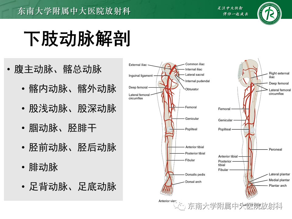 影像PPT - 【PPT】下肢动脉硬化闭塞症-4 影像PPT - 【PPT】下肢动脉硬化闭塞症-4