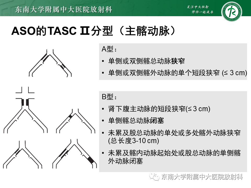 影像PPT - 【PPT】下肢动脉硬化闭塞症-20 影像PPT - 【PPT】下肢动脉硬化闭塞症-20