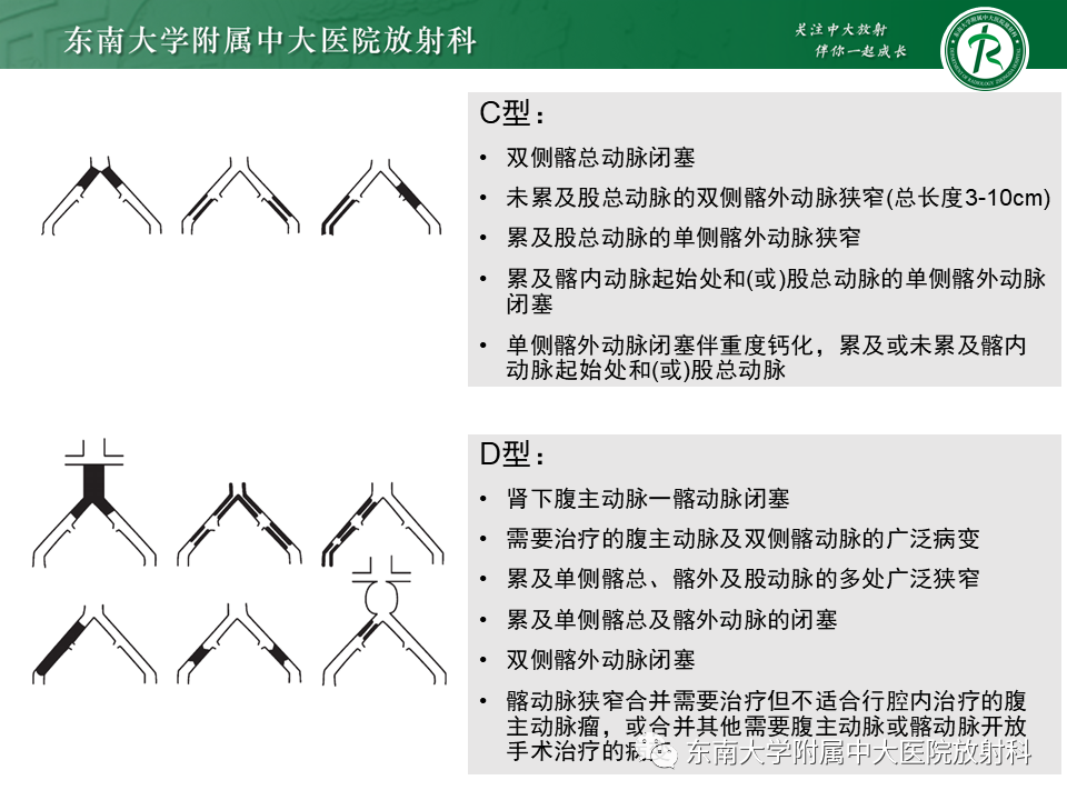 影像PPT - 【PPT】下肢动脉硬化闭塞症-21 影像PPT - 【PPT】下肢动脉硬化闭塞症-21