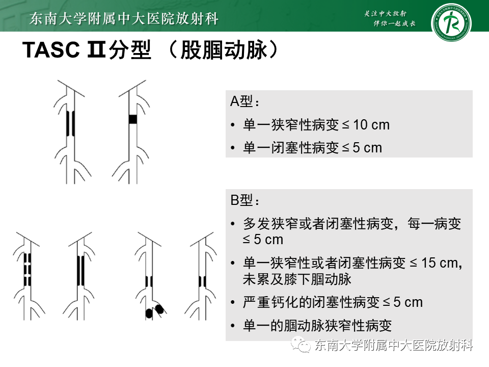 影像PPT - 【PPT】下肢动脉硬化闭塞症-22 影像PPT - 【PPT】下肢动脉硬化闭塞症-22