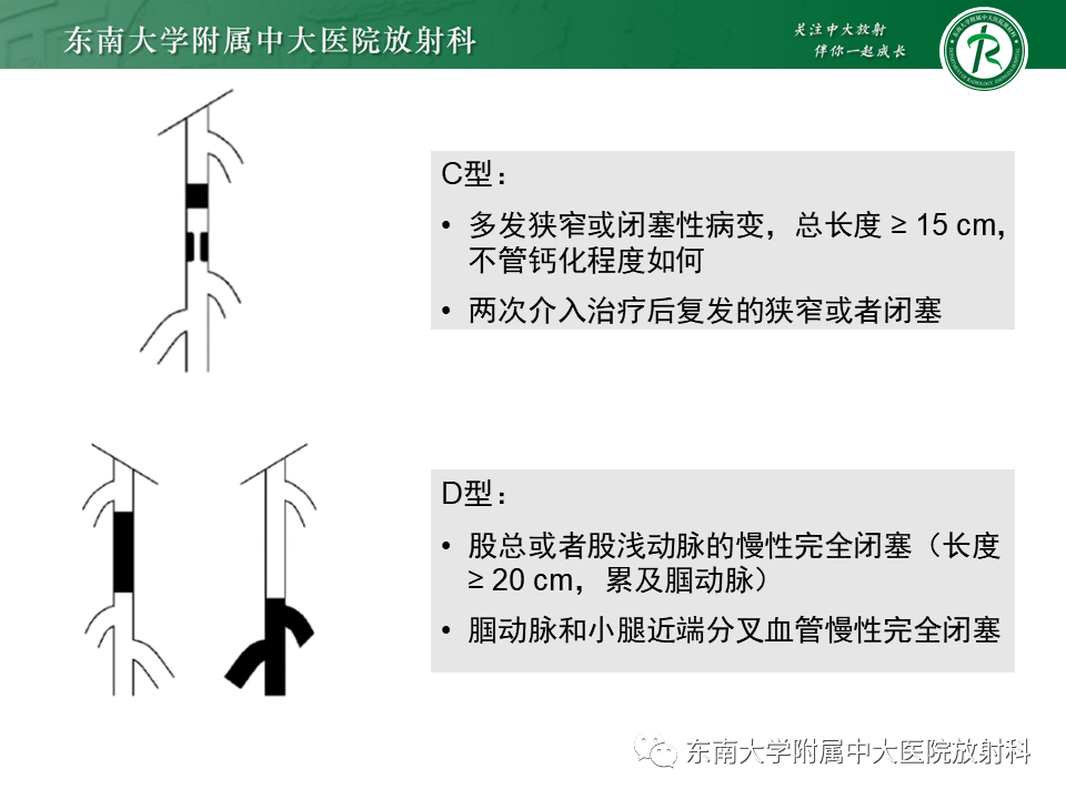 影像PPT - 【PPT】下肢动脉硬化闭塞症-23 影像PPT - 【PPT】下肢动脉硬化闭塞症-23