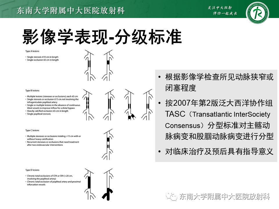 影像PPT - 【PPT】下肢动脉硬化闭塞症-19 影像PPT - 【PPT】下肢动脉硬化闭塞症-19