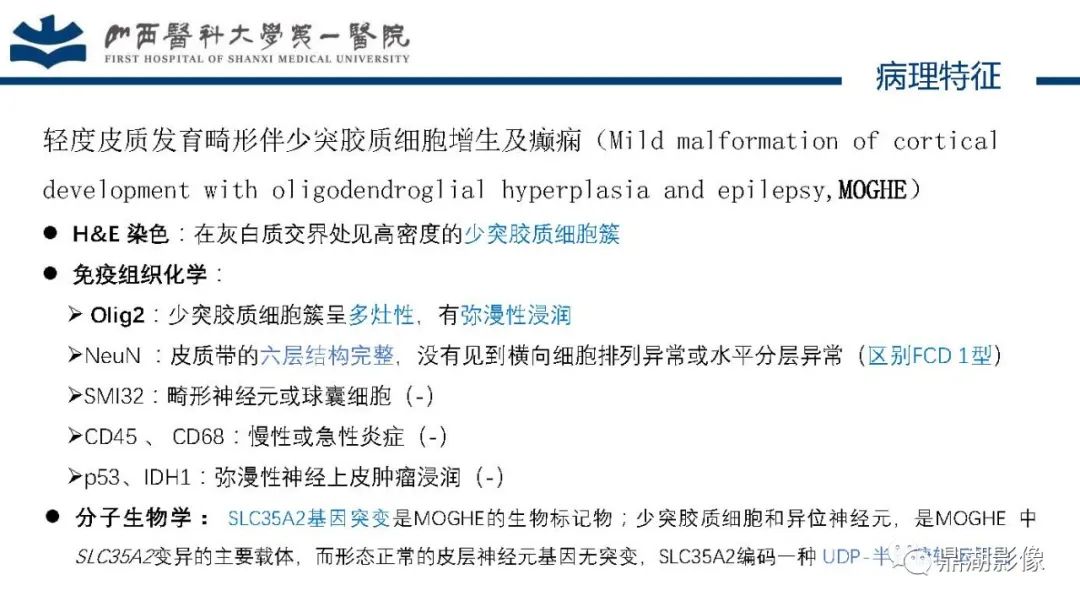 影像PPT - 【PPT】MOGHE的MRI诊断与鉴别诊断-7 影像PPT - 【PPT】MOGHE的MRI诊断与鉴别诊断-7
