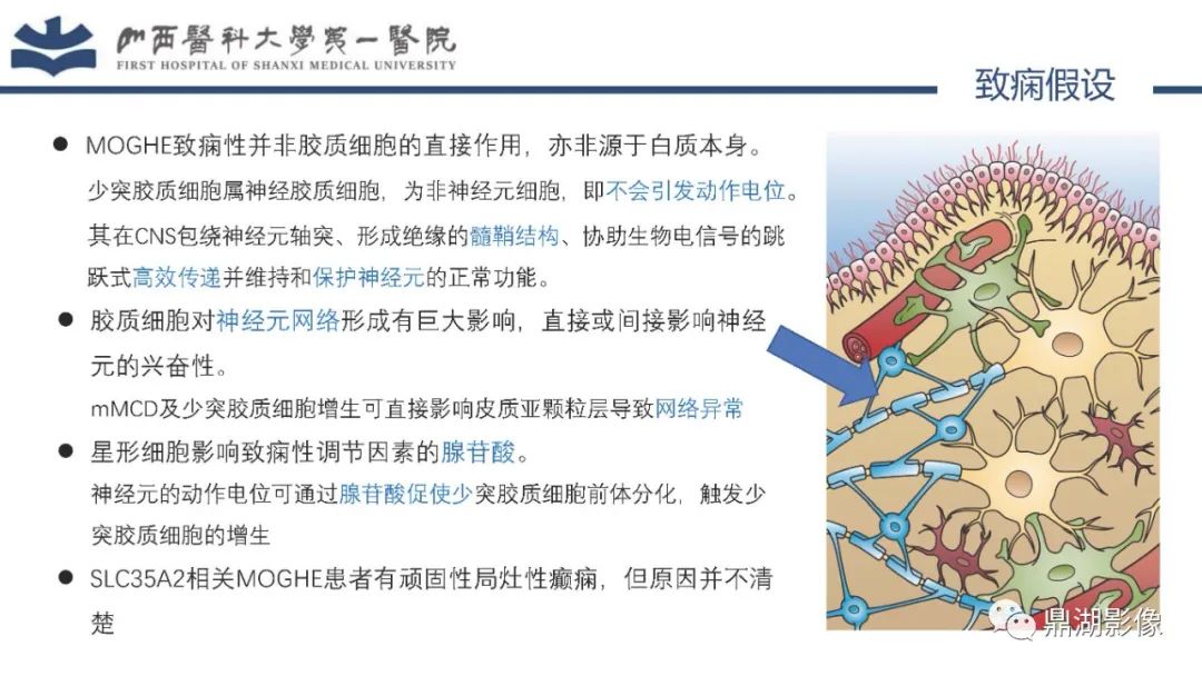 影像PPT - 【PPT】MOGHE的MRI诊断与鉴别诊断-9 影像PPT - 【PPT】MOGHE的MRI诊断与鉴别诊断-9