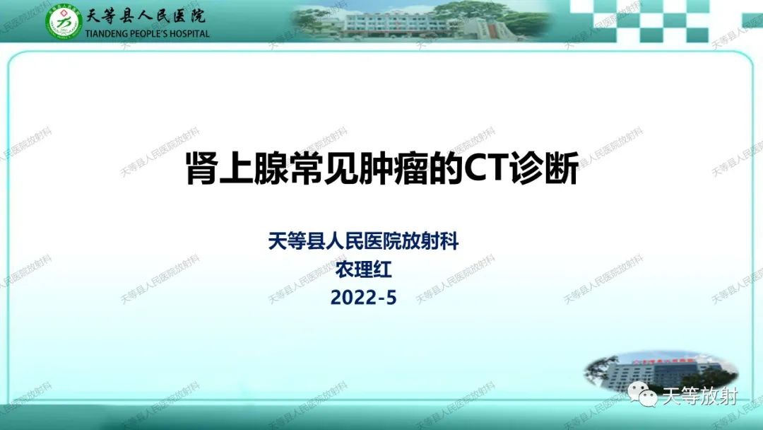 影像PPT - 【PPT】肾上腺常见肿瘤的CT诊断-1