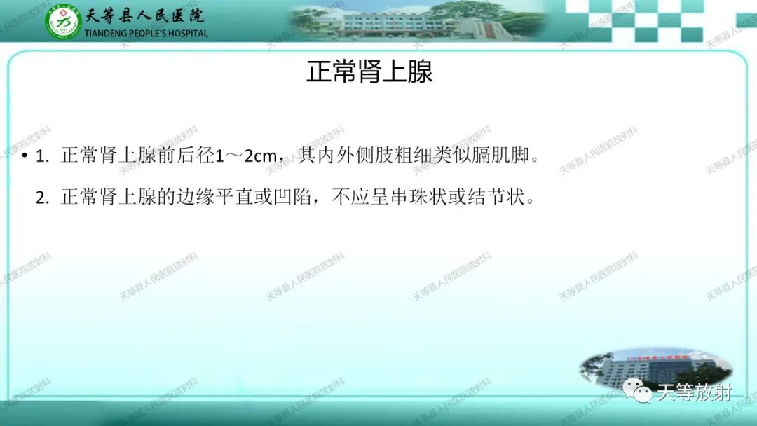 影像PPT - 【PPT】肾上腺常见肿瘤的CT诊断-3