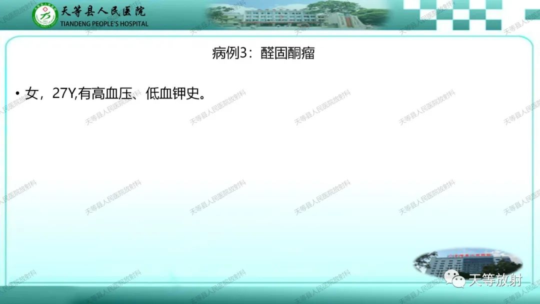 影像PPT - 【PPT】肾上腺常见肿瘤的CT诊断-10