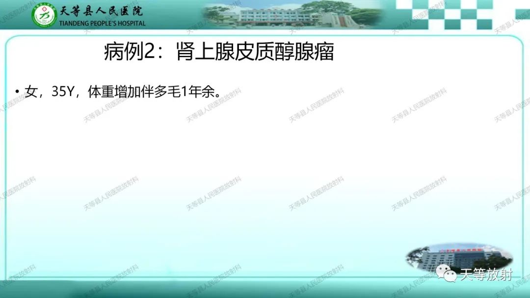 影像PPT - 【PPT】肾上腺常见肿瘤的CT诊断-8
