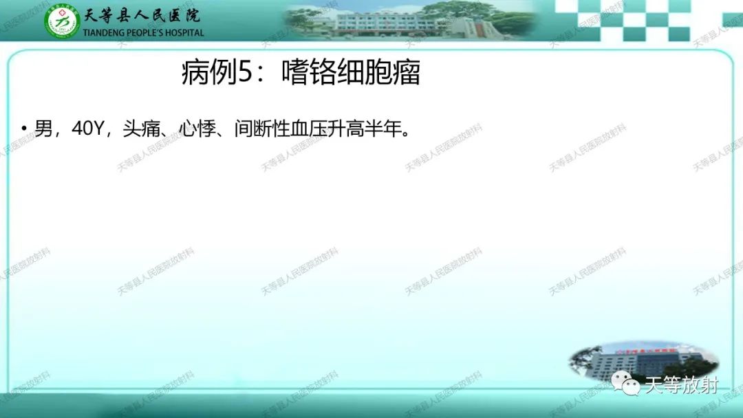 影像PPT - 【PPT】肾上腺常见肿瘤的CT诊断-14