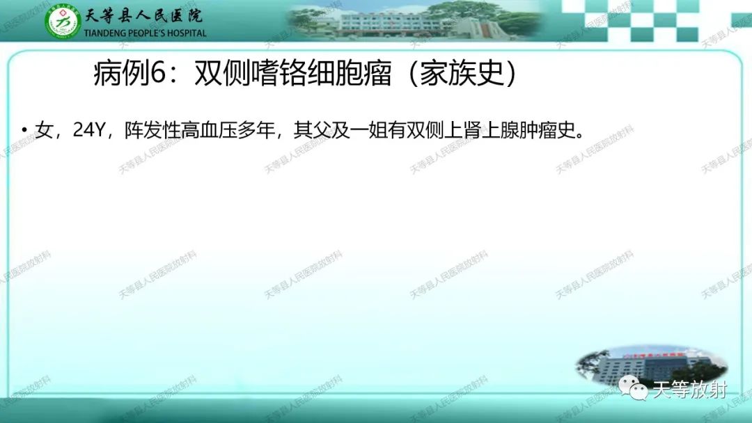影像PPT - 【PPT】肾上腺常见肿瘤的CT诊断-16