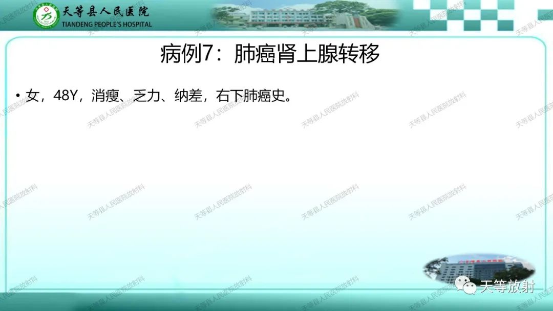 影像PPT - 【PPT】肾上腺常见肿瘤的CT诊断-18