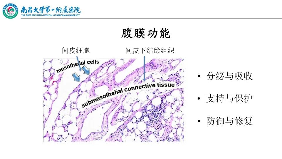 影像PPT - 【PPT】腹膜解剖及常见疾病的影像诊断-4
