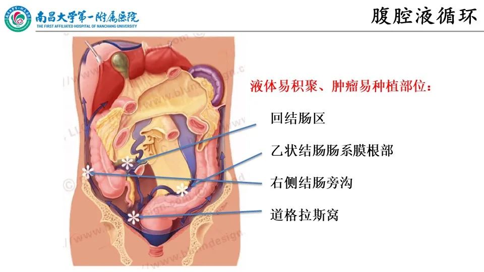 影像PPT - 【PPT】腹膜解剖及常见疾病的影像诊断-11