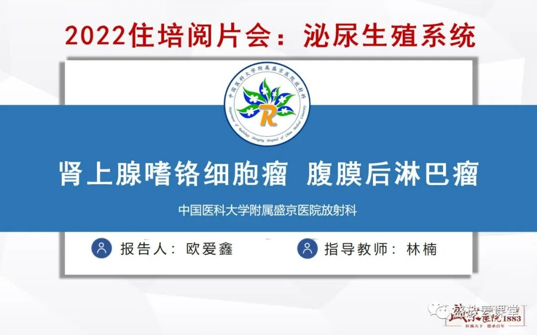 影像PPT - 【病例】肾上腺嗜铬细胞瘤 腹膜后淋巴瘤-1