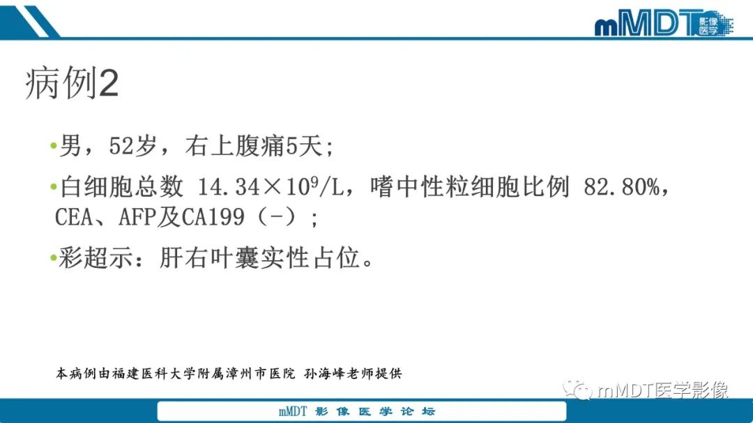 影像PPT - 【PPT】肝炎性肌纤维母细胞瘤-17 影像PPT - 【PPT】肝炎性肌纤维母细胞瘤-17