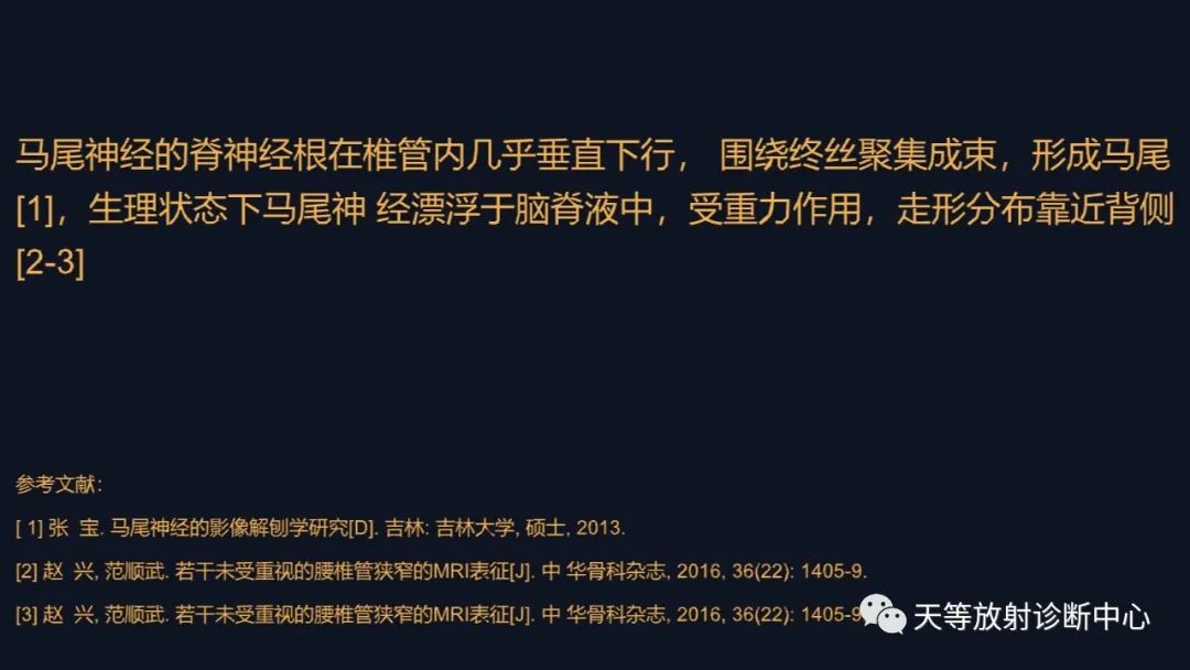 影像PPT - 马尾神经冗余征:马尾神经扭曲-2 影像PPT - 马尾神经冗余征:马尾神经扭曲-2