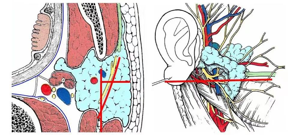 影像PPT - 【病例】腮腺腺淋巴瘤1例MR影像诊断-9 影像PPT - 【病例】腮腺腺淋巴瘤1例MR影像诊断-9