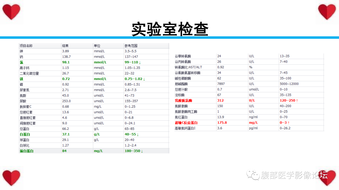影像PPT - 【PPT】胰腺实性假乳头状瘤（SPN）影像诊断-4