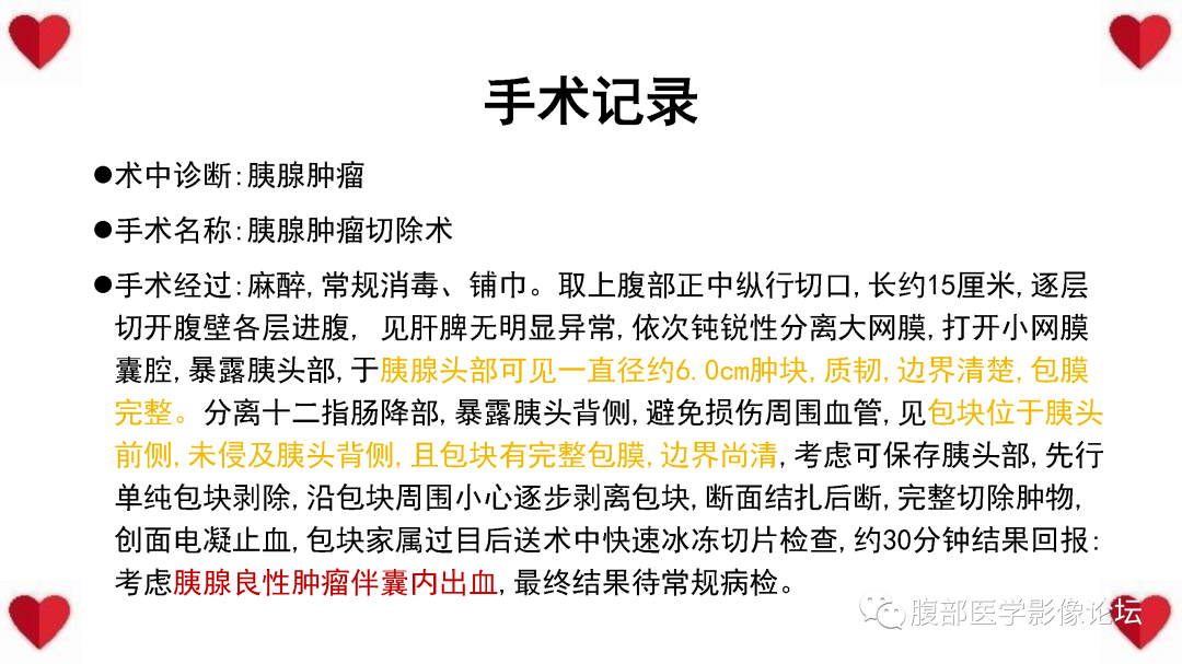影像PPT - 【PPT】胰腺实性假乳头状瘤（SPN）影像诊断-24