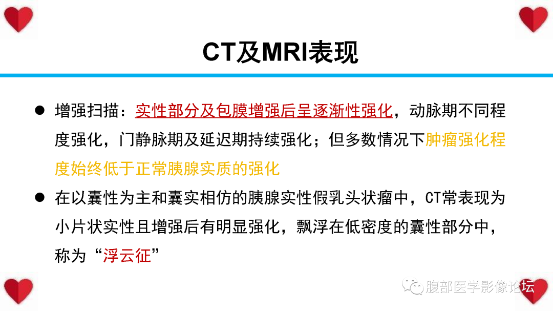 影像PPT - 【PPT】胰腺实性假乳头状瘤（SPN）影像诊断-37