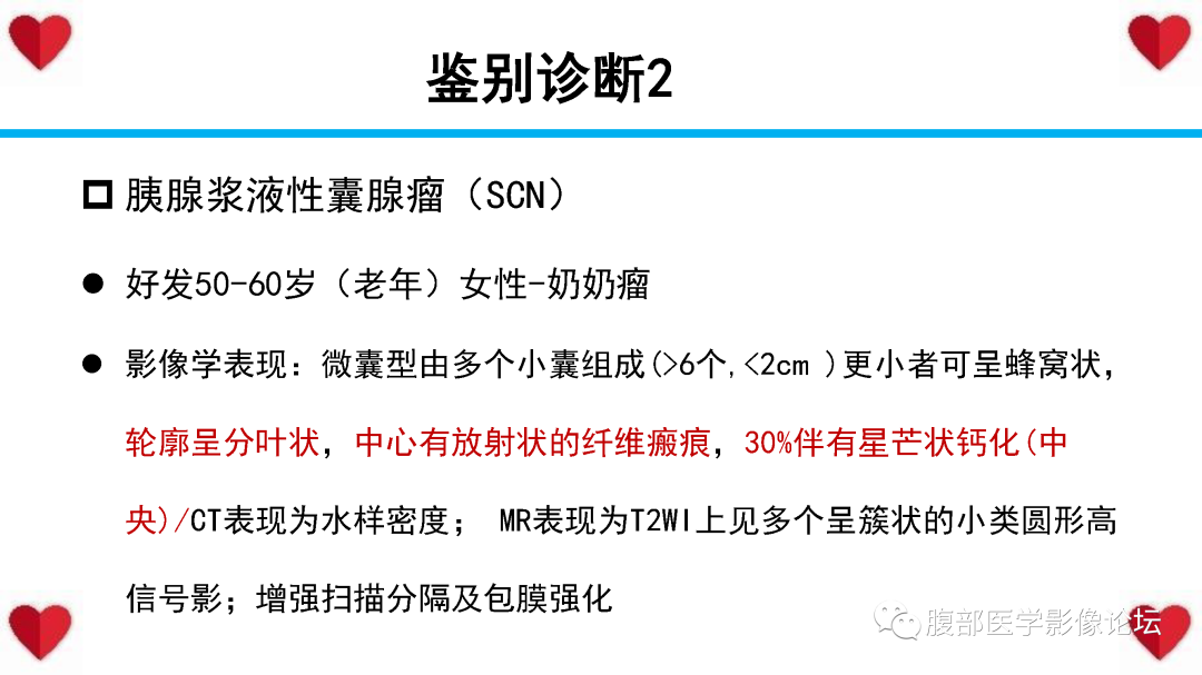 影像PPT - 【PPT】胰腺实性假乳头状瘤（SPN）影像诊断-49