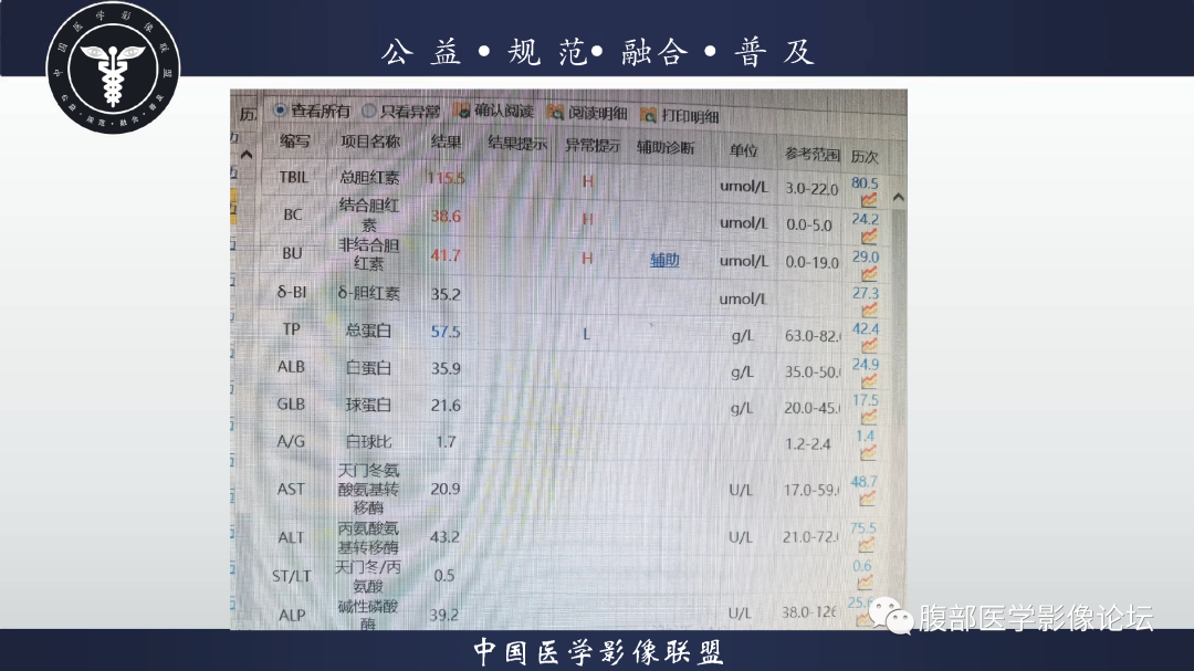 影像PPT - 【病例】恶性外周神经鞘瘤1例CT及MR影像诊断-4