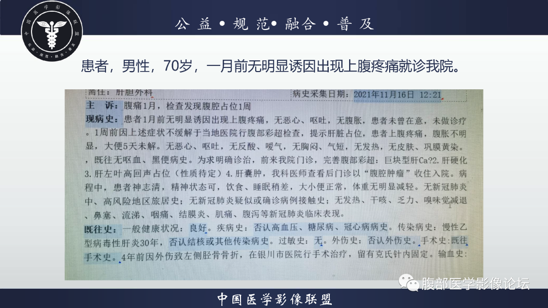 影像PPT - 【病例】恶性外周神经鞘瘤1例CT及MR影像诊断-2