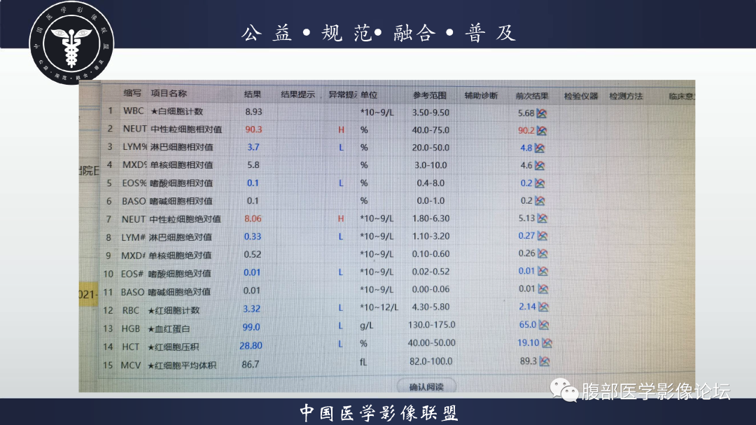 影像PPT - 【病例】恶性外周神经鞘瘤1例CT及MR影像诊断-3