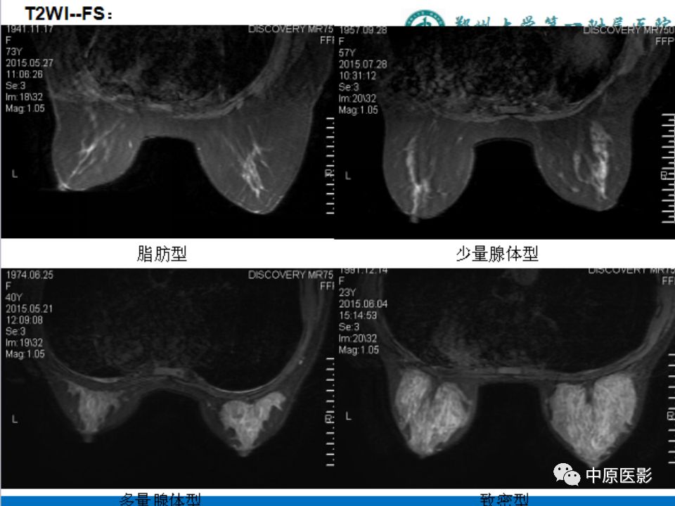 影像PPT - 【PPT】MRI对乳腺癌的诊断价值-6