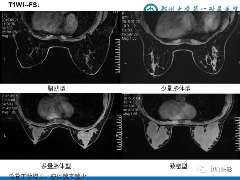 影像PPT - 【PPT】MRI对乳腺癌的诊断价值-7