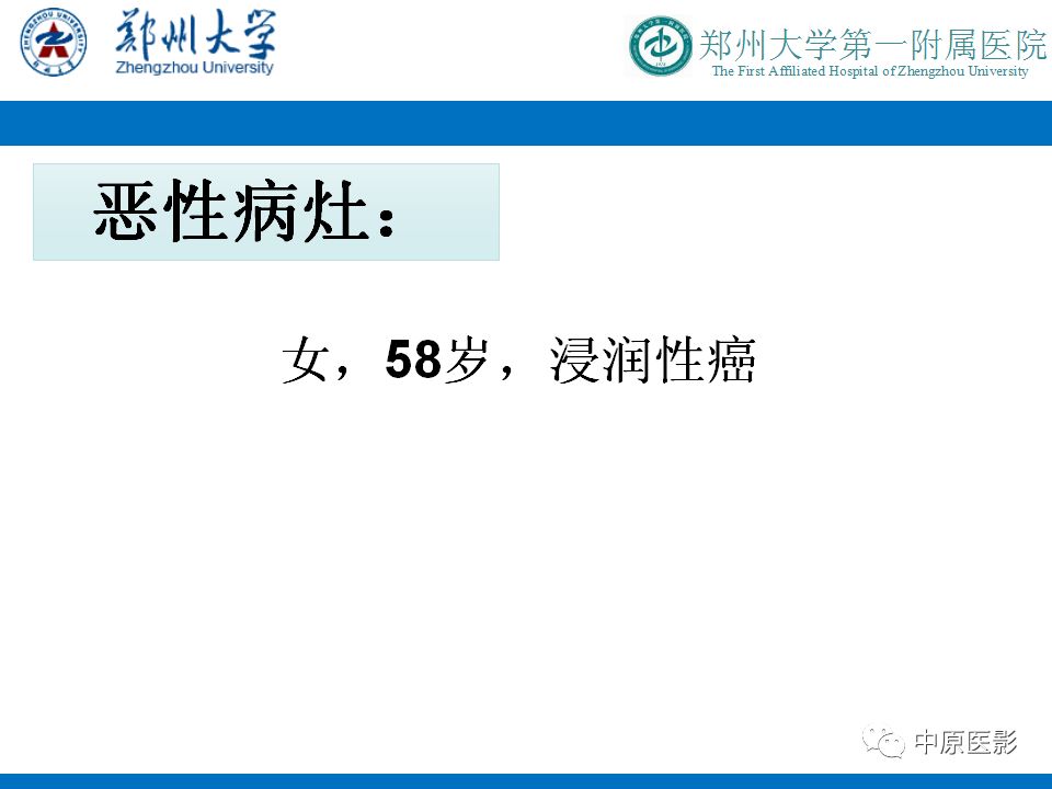 影像PPT - 【PPT】MRI对乳腺癌的诊断价值-18