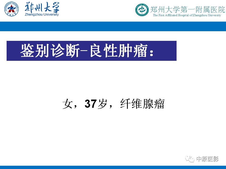 影像PPT - 【PPT】MRI对乳腺癌的诊断价值-28