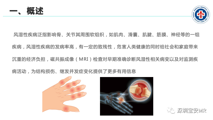 影像PPT - 【PPT】磁共振成像在风湿性疾病中的应用-2